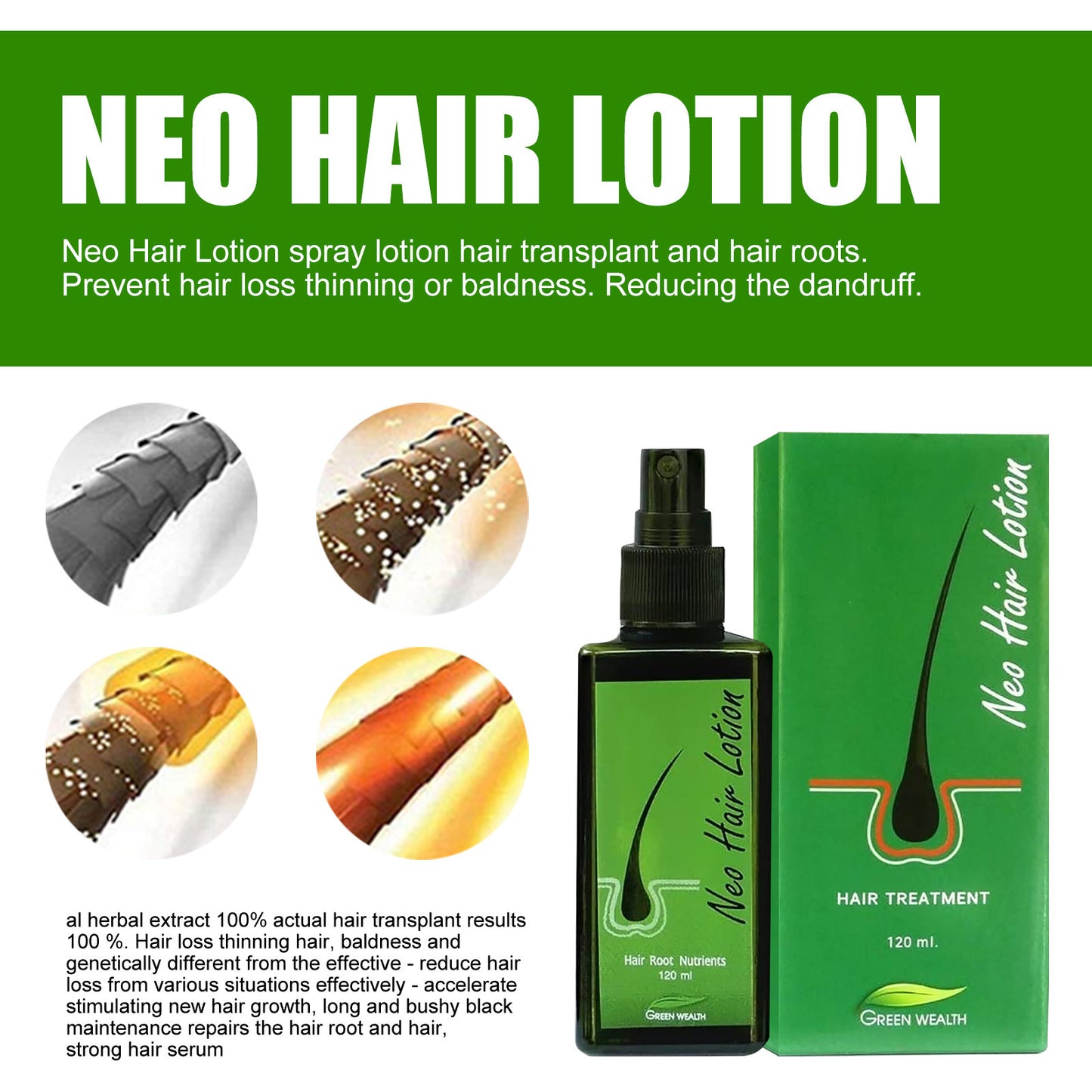 Meta Digital Store Hair Care Growth Lotion Spray